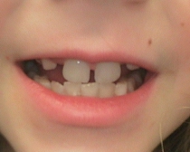 Dentistry for Children 2 